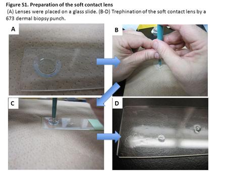 Figure S1. Preparation of the soft contact lens (A) Lenses were placed on a glass slide. (B-D) Trephination of the soft contact lens by a 673 dermal biopsy.