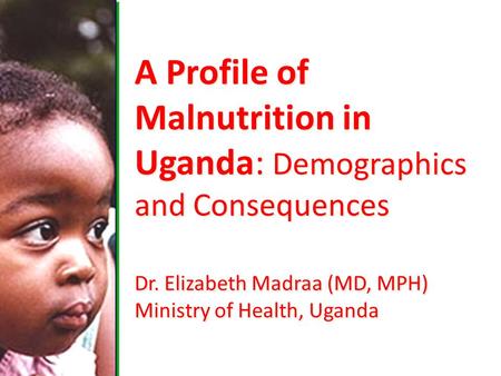 A Profile of Malnutrition in Uganda: Demographics and Consequences Dr. Elizabeth Madraa (MD, MPH) Ministry of Health, Uganda.