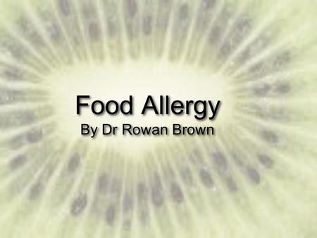 Food Allergy By Dr Rowan Brown. Problem Common - (1.6 - 8% of population) Attitude - Medical vs Common Opinion Service Provision - access to specialist.