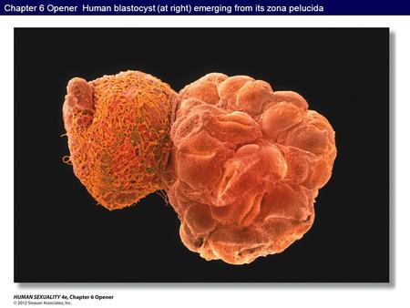 Chapter 6 Opener Human blastocyst (at right) emerging from its zona pelucida.