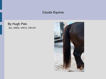 Cauda Equina By Hugh Pelc Bsc, MBBS, MRCS, MRCGP.