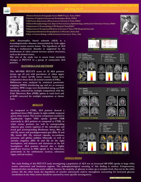 1 Positron Emission Tomography Center IRMET S.p.A., Turin, ITALY 2 Institute of Cognitive Sciences and Technologies, Rome, ITALY 3 ALS Center, Department.