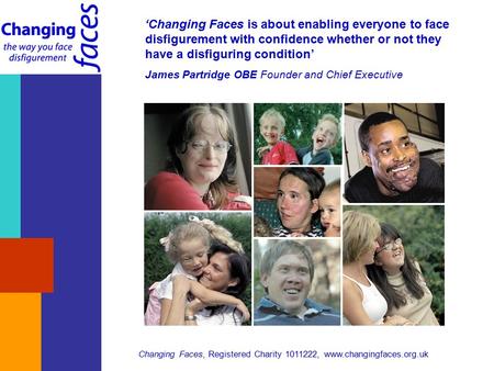 Changing Faces, Registered Charity 1011222, www.changingfaces.org.uk ‘Changing Faces is about enabling everyone to face disfigurement with confidence whether.