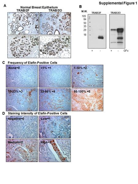 TRAB/2FTRAB/2O A Normal Breast Epithelium Supplemental Figure 1 iii iii iv 105 84 50 35 29 18 TRAB/2FTRAB/2O + - + - GFs B M.W. None=0