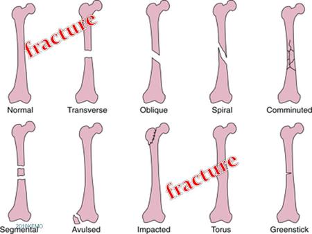 KEMO2010. Introduction  The body is built on a framework of bones called the skeleton.  The skeleton are 206 bones in the human body.  It structure.