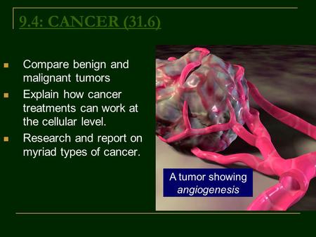 A tumor showing angiogenesis