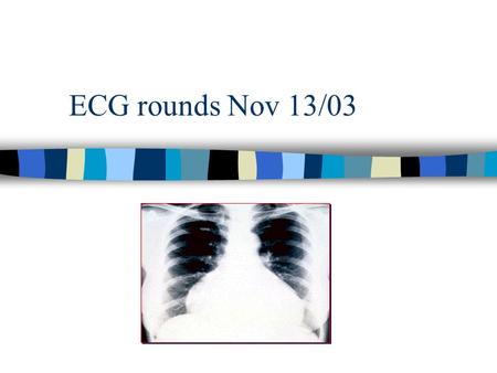 ECG rounds Nov 13/03. 26 year old soccer player n retrosternal chest pain. n visiting from Egypt and did not speak English. A friend gives a limited history.