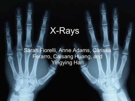 X-Rays Sarah Fiorelli, Anne Adams, Carissa Ferarro, Caisang Huang, and Yingying Han X-Rays.