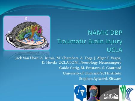 Jack Van Horn, A. Irimia, M. Chambers, A. Toga, J. Alger, P. Vespa, D. Hovda UCLA LONI, Neurology, Neurosurgery Guido Gerig, M. Prastawa, S. Gouttard University.