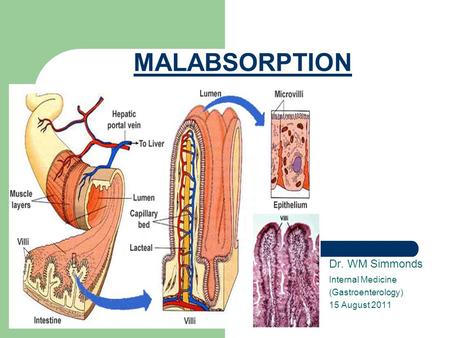 MALABSORPTION Dr. WM Simmonds Internal Medicine (Gastroenterology) 15 August 2011.