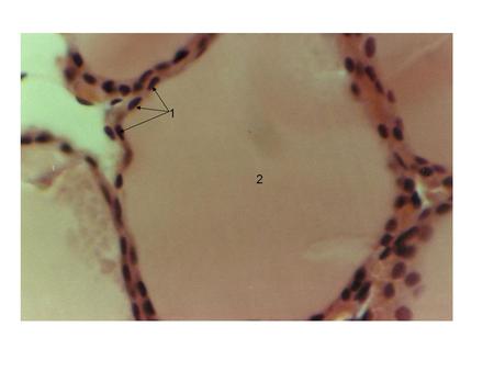 2 1. Colloid containing thyroglobulin / Stored thyroid hormone Follicular cells (nuclei of)