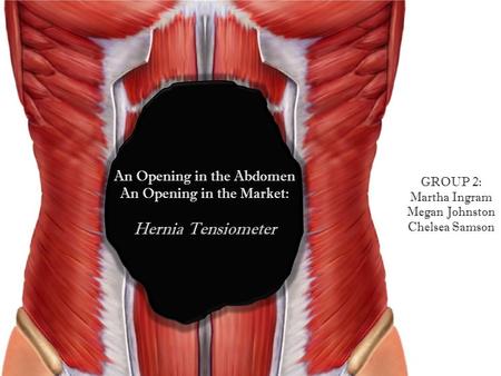 An Opening in the Abdomen An Opening in the Market: Hernia Tensiometer GROUP 2: Martha Ingram Megan Johnston Chelsea Samson.