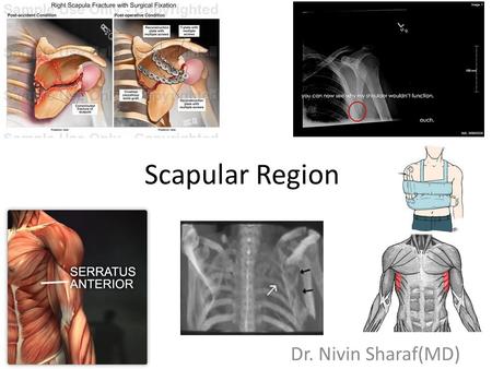 Scapular Region artmiller.medicalillustration.com Dr. Nivin Sharaf(MD)