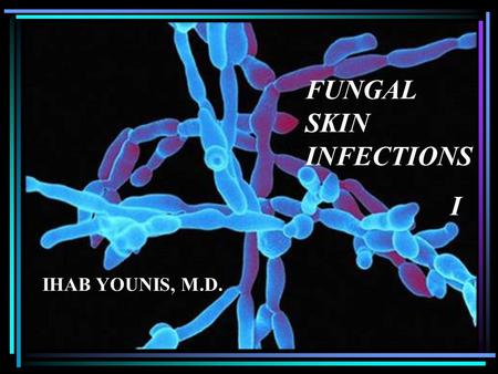 Selling a Product or Service FUNGAL SKIN INFECTIONS I IHAB YOUNIS, M.D.