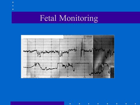 Fetal Monitoring Introduction 1600’s Kilian proposes the use of fetal heart rate to diagnose fetal distress 1893 criteria for determining fetal distress.