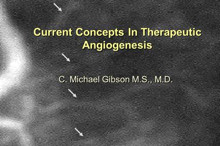 Current Concepts In Therapeutic Angiogenesis C. Michael Gibson M.S., M.D.