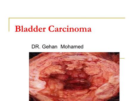 Bladder Carcinoma DR. Gehan Mohamed.