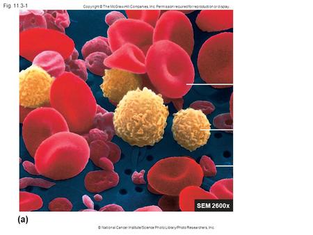 Fig. 11.3-1 Copyright © The McGraw-Hill Companies, Inc. Permission required for reproduction or display. © National Cancer Institute/Science Photo Library/Photo.