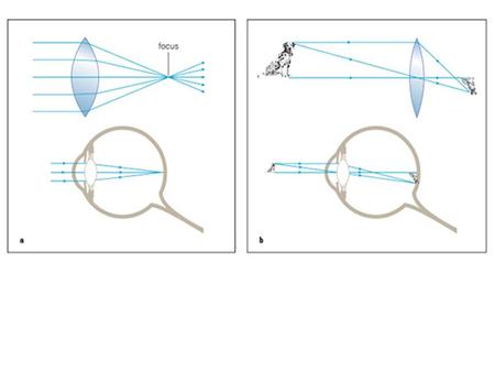 Refracting telescope. Refracting telescope The Galilean telescope           The objective lens, whose focal length is f, performs the same function.