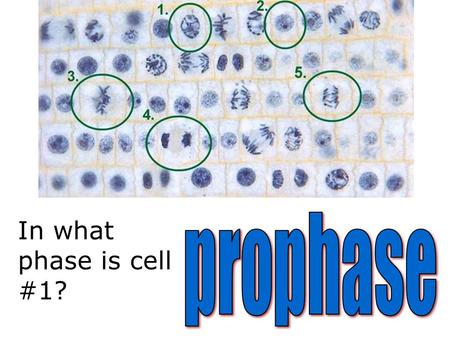 In what phase is cell #1?. Name this part of the microscope.