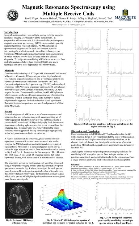 Introduction Many clinicians routinely use multiple receive coils for magnetic resonance imaging (MRI) studies of the human brain. In conjunction with.