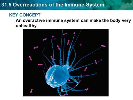 Allergies occur when the immune system responds to harmless antigens.