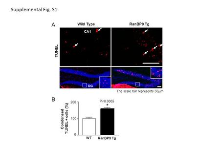 0 100 200 Condensed TUNEL + cells (%) WT RanBP9 Tg B The scale bar represents 50  m A CA1 TUNEL Wild TypeRanBP9 Tg P