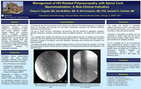 Management of HIV-Related Polyneuropathy with Spinal Cord Neuromodulation: A New Clinical Indication Management of HIV-Related Polyneuropathy with Spinal.