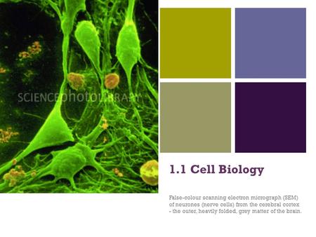 + 1.1 Cell Biology False-colour scanning electron micrograph (SEM) of neurones (nerve cells) from the cerebral cortex - the outer, heavily folded, grey.