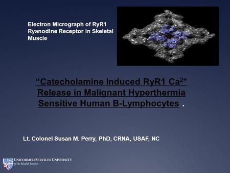 Electron Micrograph of RyR1