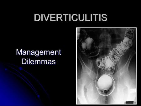 DIVERTICULITIS Management Dilemmas. Diverticulitis Common in Western and industrialised societies ~ 300,000 hospitalisations yearly in the United States.