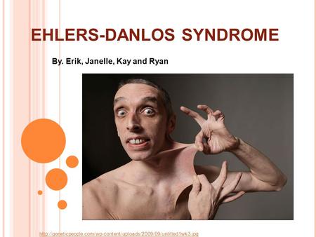 EHLERS-DANLOS SYNDROME