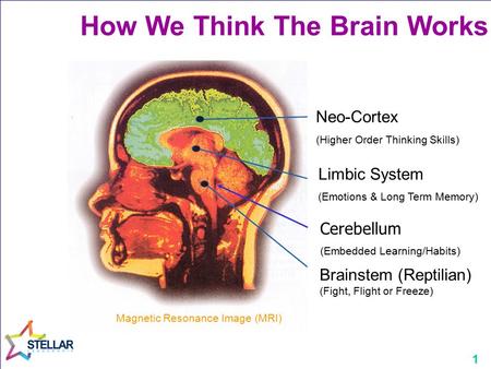 Magnetic Resonance Image (MRI)