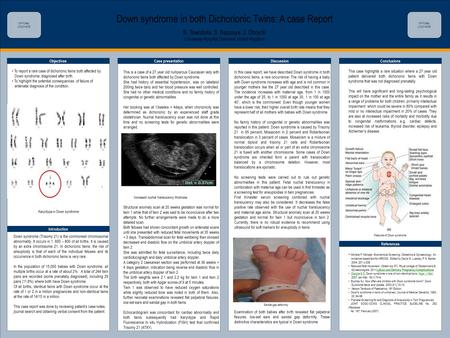 TEMPLATE DESIGN © 2008 www.PosterPresentations.com Down syndrome in both Dichorionic Twins: A case Report B. Towobola, S. Bazuaye, J. Obrycki Causeway.