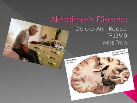 Alzheimer's Disease was named after Dr.Alois Alzheimer in 1906.