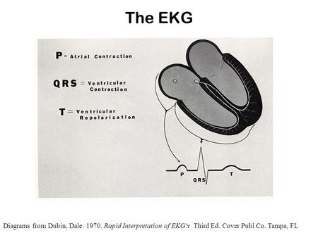 The EKG Diagrams from Dubin, Dale. 1970. Rapid Interpretation of EKG'x Third Ed. Cover Publ Co. Tampa, FL.