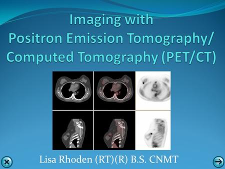 Lisa Rhoden (RT)(R) B.S. CNMT PET PET permits investigation and comparison of events occurring at the molecular and cellular level. This data is not.