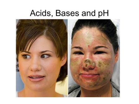 Acids, Bases and pH. Properties of Acids and Bases.