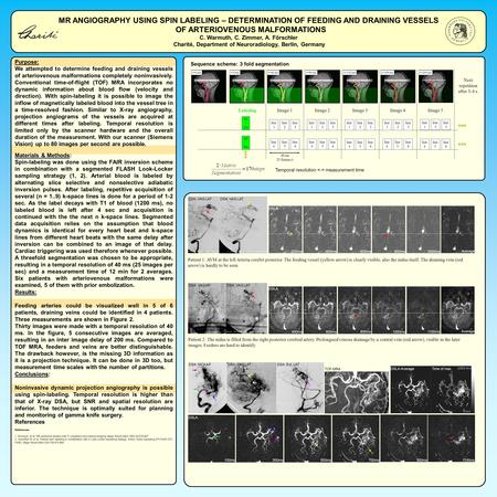 MR ANGIOGRAPHY USING SPIN LABELING – DETERMINATION OF FEEDING AND DRAINING VESSELS OF ARTERIOVENOUS MALFORMATIONS C. Warmuth, C. Zimmer, A. Förschler Charité,