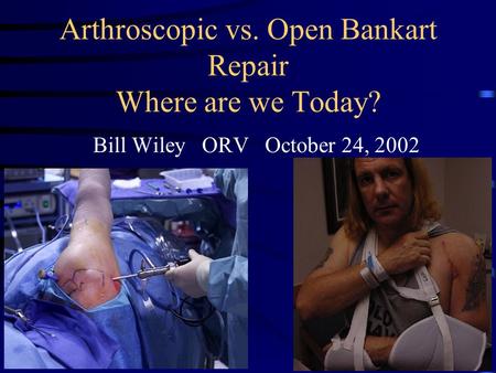 Arthroscopic vs. Open Bankart Repair Where are we Today? Bill Wiley ORV October 24, 2002.