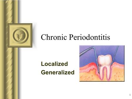 Chronic Periodontitis