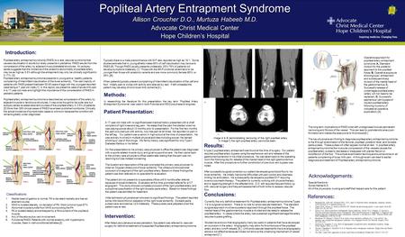 Popliteal Artery Entrapment Syndrome Allison Croucher D.O., Murtuza Habeeb M.D. Advocate Christ Medical Center Hope Children’s Hospital Popliteal Artery.