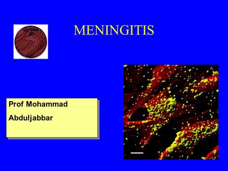 MENINGITIS Prof Mohammad Abduljabbar Prof Mohammad Abduljabbar.