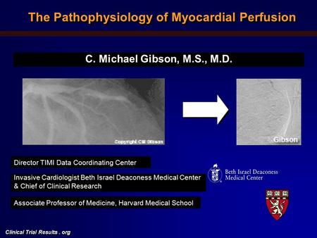 Clinical Trial Results. org C. Michael Gibson, M.S., M.D. Director TIMI Data Coordinating Center Invasive Cardiologist Beth Israel Deaconess Medical Center.