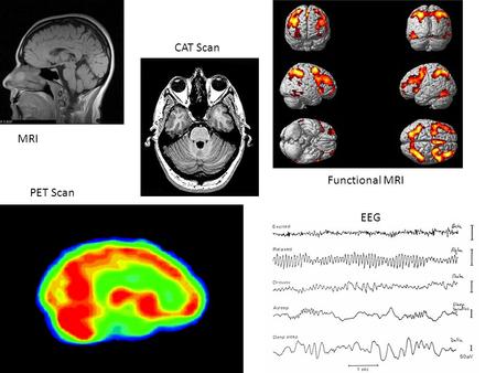 CAT Scan MRI Functional MRI PET Scan EEG.