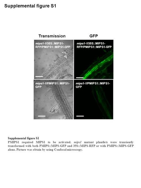 Mips1-1/35S::MIPS1- RFP/PMIPS1::MIPS1-GFP mips1-1/PMIPS1::MIPS1- GFP mips1-1/35S::MIPS1- RFP/PMIPS1::MIPS1-GFP mips1-1/PMIPS1::MIPS1- GFP GFPTransmission.