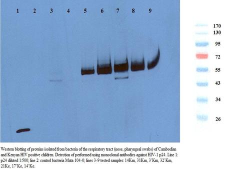 Western blotting of proteins isolated from bacteria and yeasts of the respiratory tract (nose, pharyngeal swabs) of Cambodian (Km) and Kenyan (Ke) HIV.