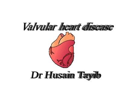 Causes of valve disease Valve regurgitation * Congenital *Acute rheumatic carditis *Chronic rhe. Carditis * I E *Syphlitic aortitis *Dilated Valve.