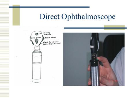 Direct Ophthalmoscope