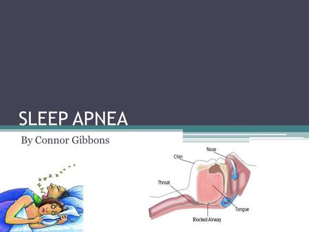 SLEEP APNEA By Connor Gibbons. What is Sleep Apnea? The stopping or halt of breathing during sleep Sleep depravation and oxygen depravation Testing is.